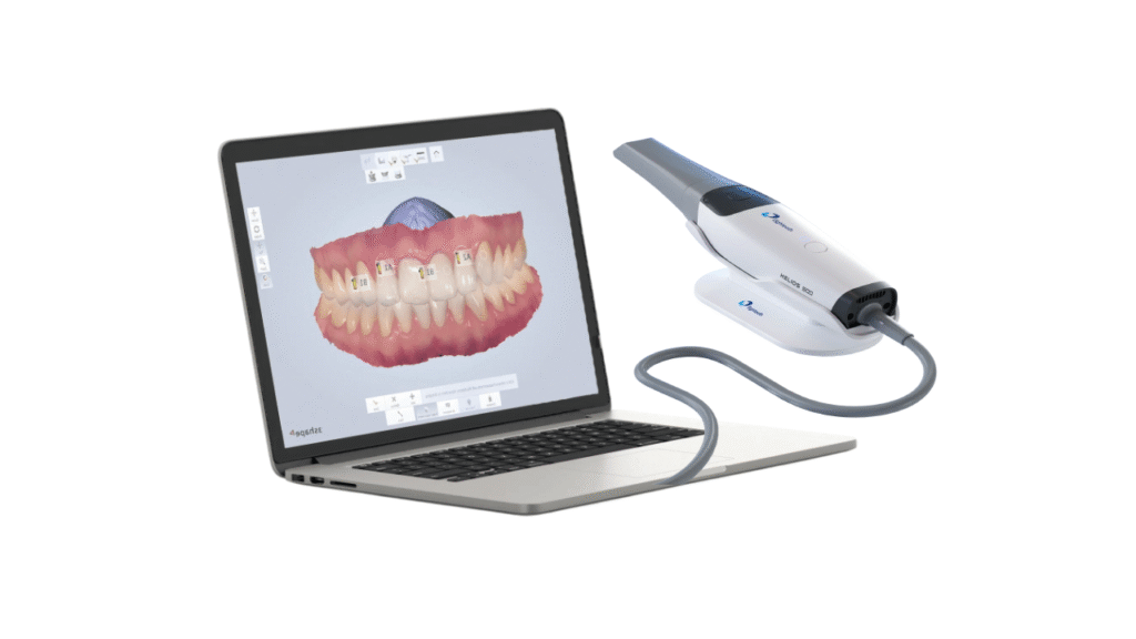 Our Digital Impression technology captures precise 3D images of your teeth and gums using a comfortable