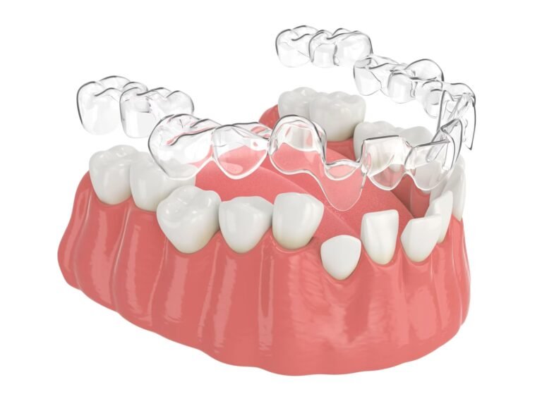 best aligners For teeth