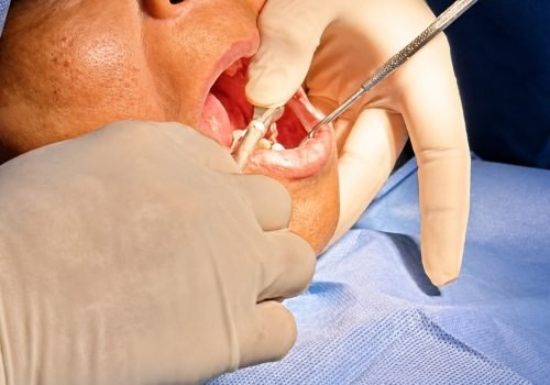 Oral Surgeries (Major & Minor) oral surgical treatments using advanced techniques and modern equipment.
