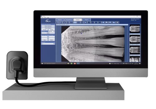 Radiovisiography (RVG) digital X-ray system. At Pure Dental Solutions