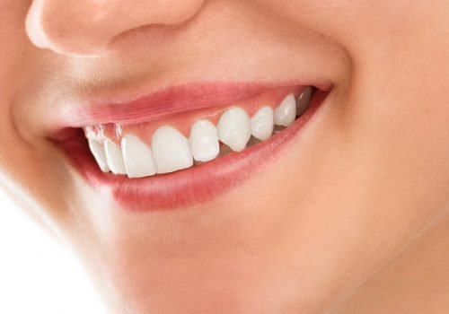 smile makeover Smile Makeover treatments to completely transform your smile